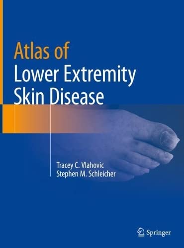 Atlas Of Lower Extremity Skin Disease Tracey C Vlahovic Stephen M Schleicher