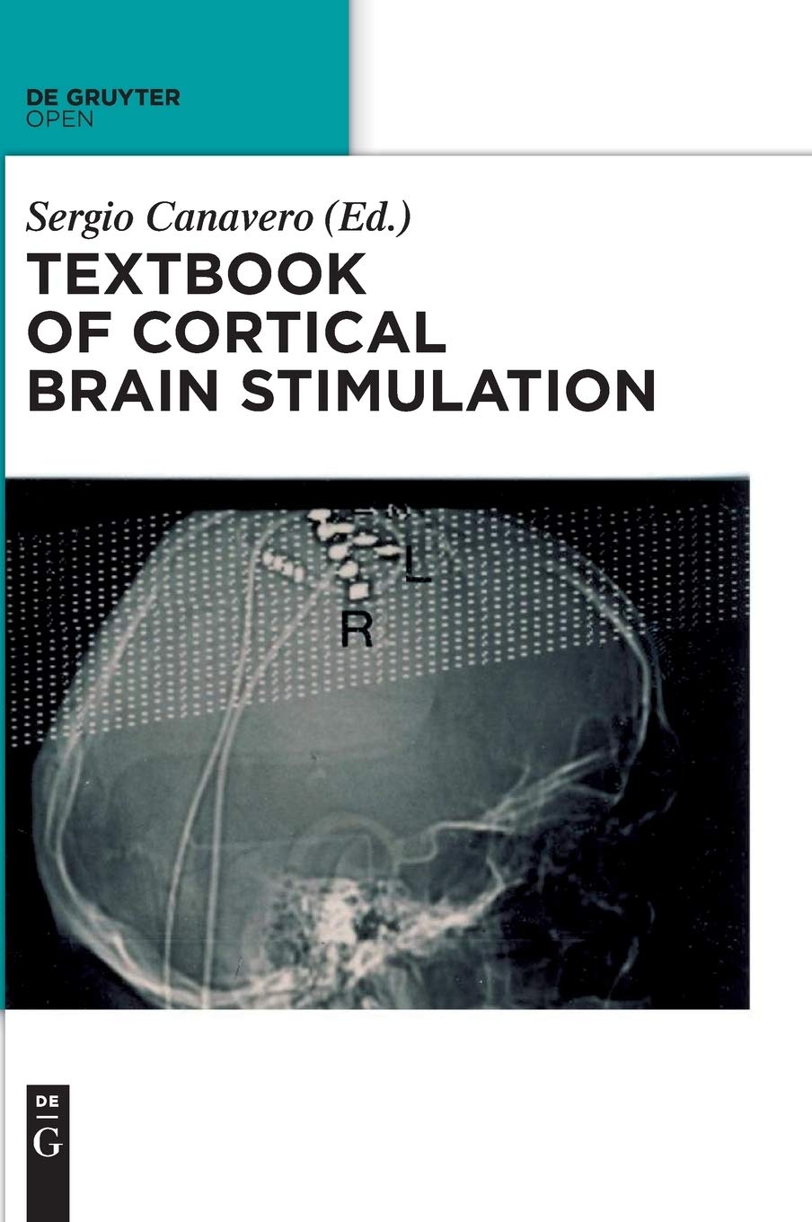 Textbook Of Cortical Brain Stimulation Sciences Sergio Canavero