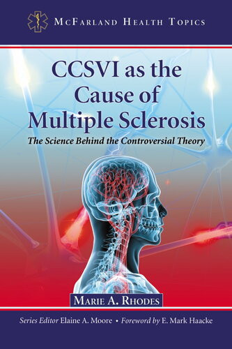 Ccsvi As The Cause Of Multiple Sclerosis The Science Behind The Controversial Theory Marie A Rhodes
