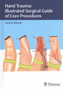 Hand Trauma Illustrated Surgical Guide Of Core Procedures Dariush Nikkhah