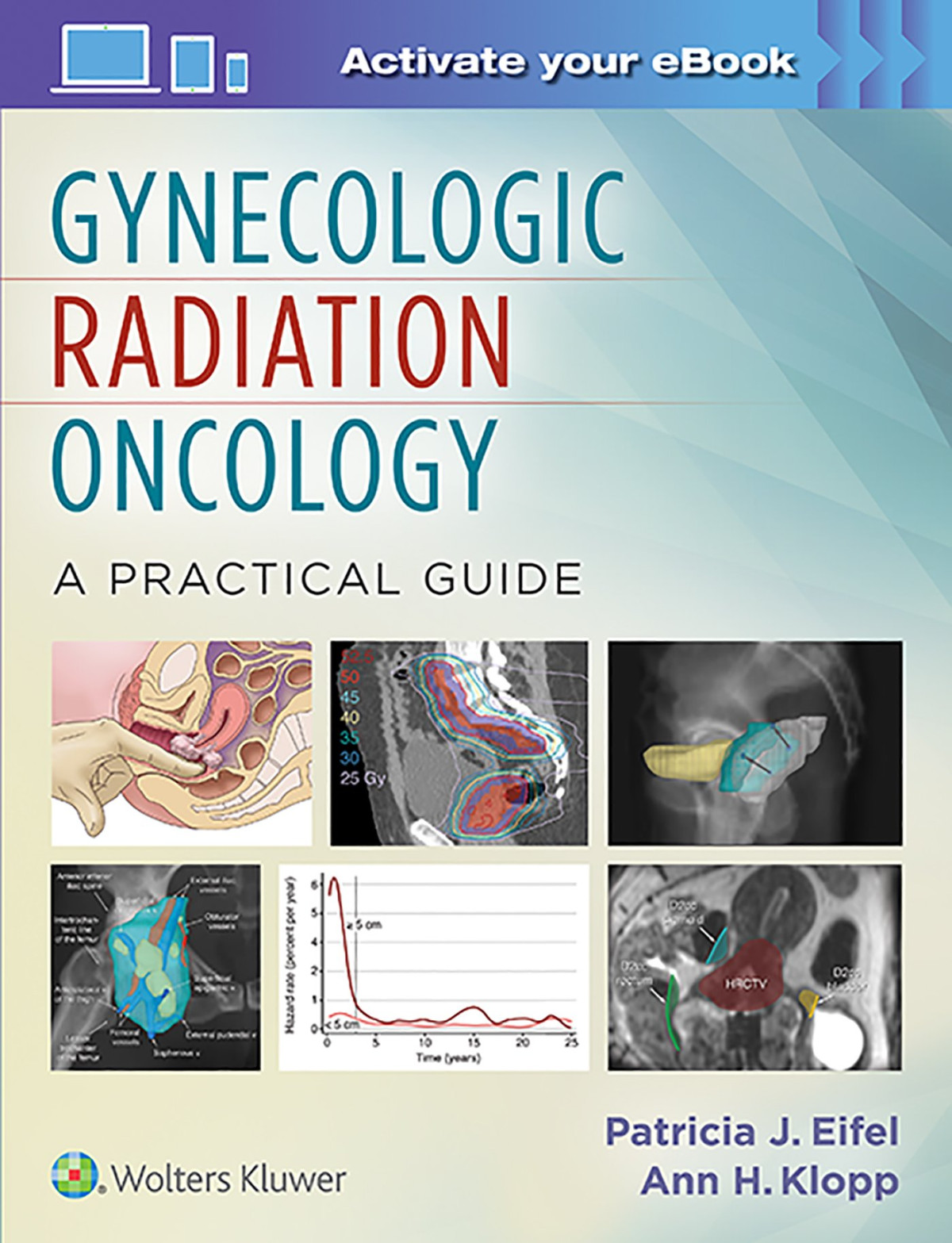 Gynecologic Radiation Oncology A Practical Guide 1st Converted Patricia J Eifel