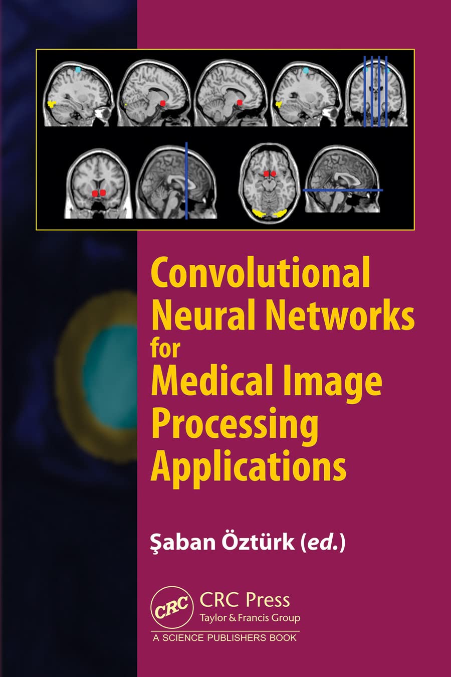 Convolutional Neural Networks For Medical Image Processing Applications Saban Ozturk