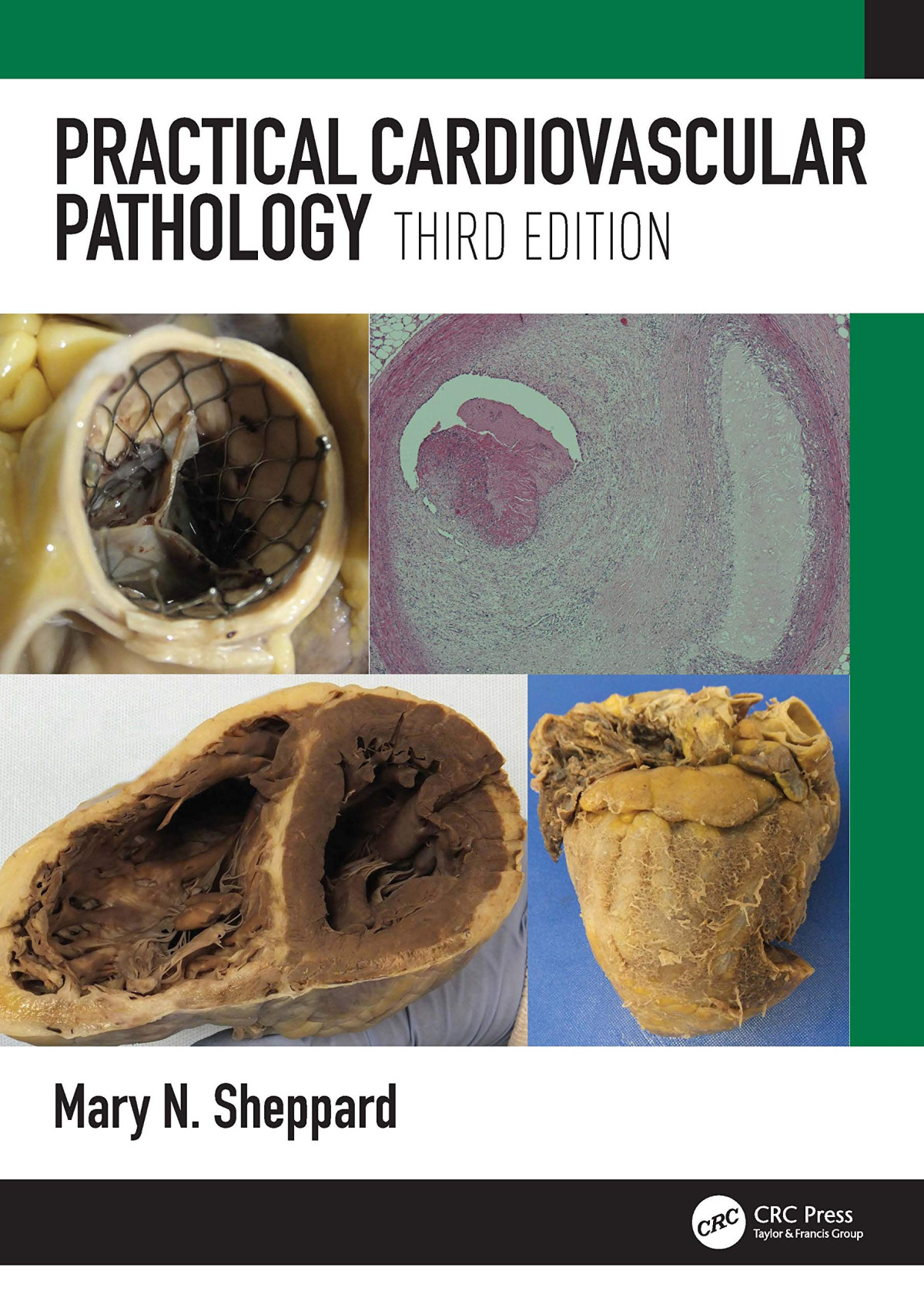 Practical Cardiovascular Pathology 3rd Edition Mary N Sheppard