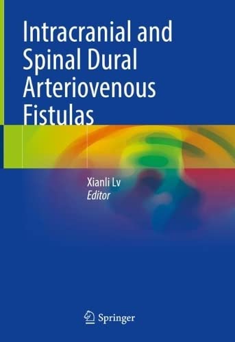 Intracranial And Spinal Dural Arteriovenous Fistulas Xianli Lv