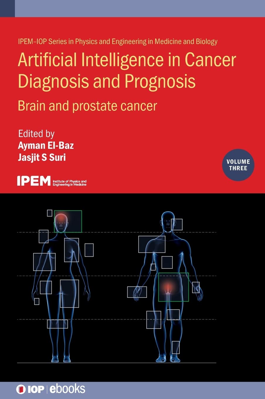 Artificial Intelligence In Cancer Diagnosis And Prognosis Volume 3 Brain And Prostate Cancer Ayman Elbaz