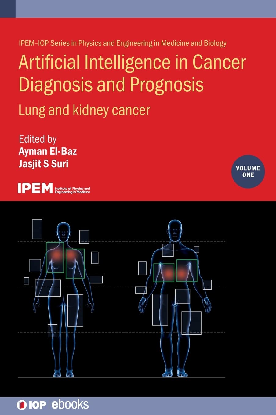 Artificial Intelligence In Cancer Diagnosis And Prognosis Volume 1 Lung And Kidney Cancer Ayman Elbaz