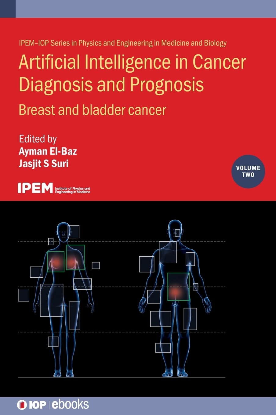 Artificial Intelligence In Cancer Diagnosis And Prognosis Volume 2 Breast And Bladder Cancer Ayman Elbaz