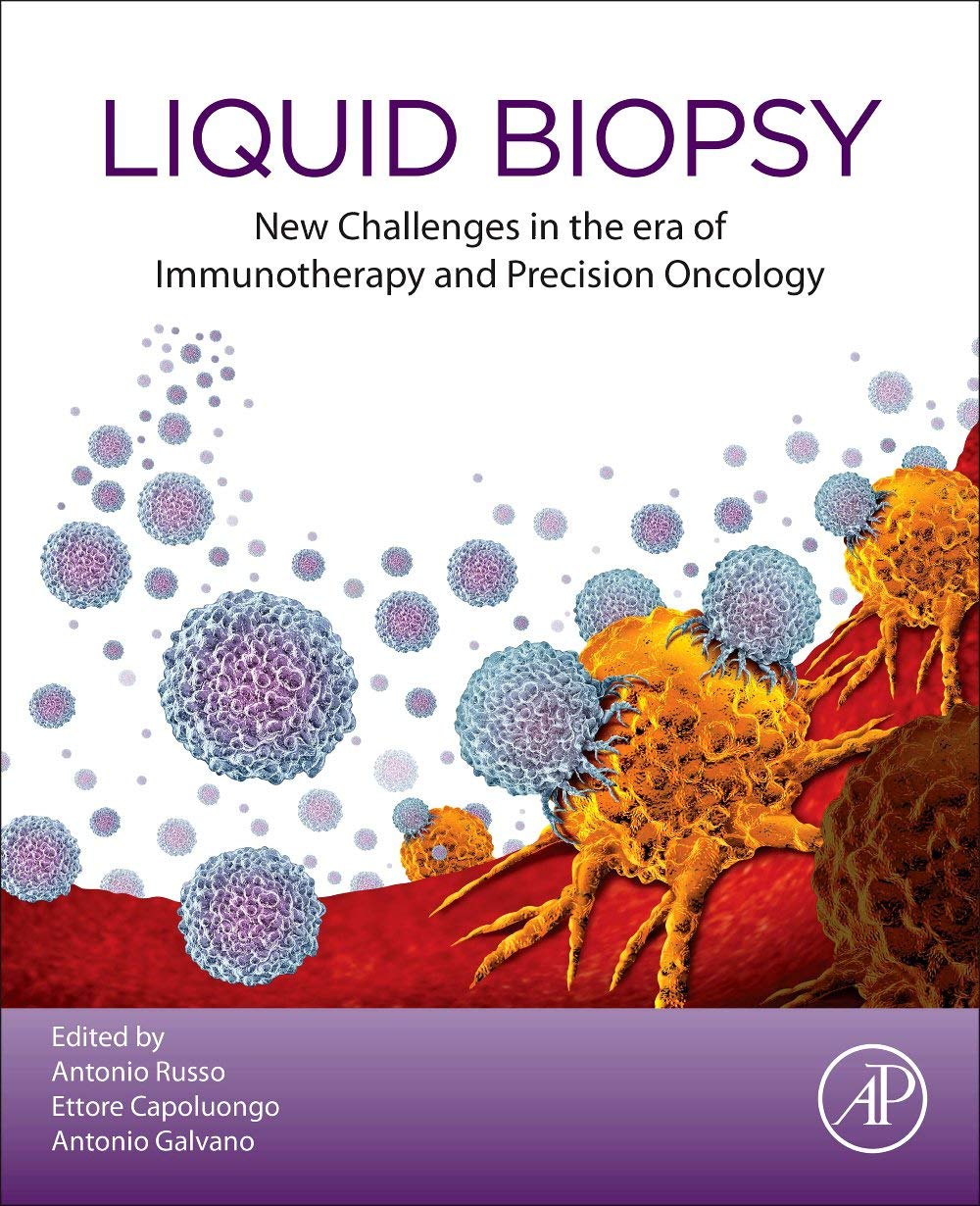 Liquid Biopsy New Challenges In The Era Of Immunotherapy And Precision Oncology Antonio Russo