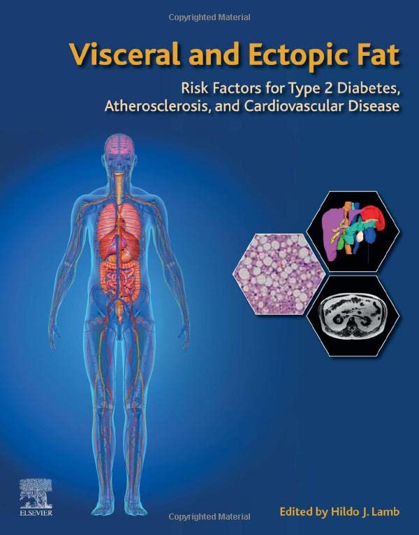 Visceral And Ectopic Fat Risk Factors For Type 2 Diabetes Atherosclerosis And Cardiovascular Disease 1st Hildo J Lamb Editor