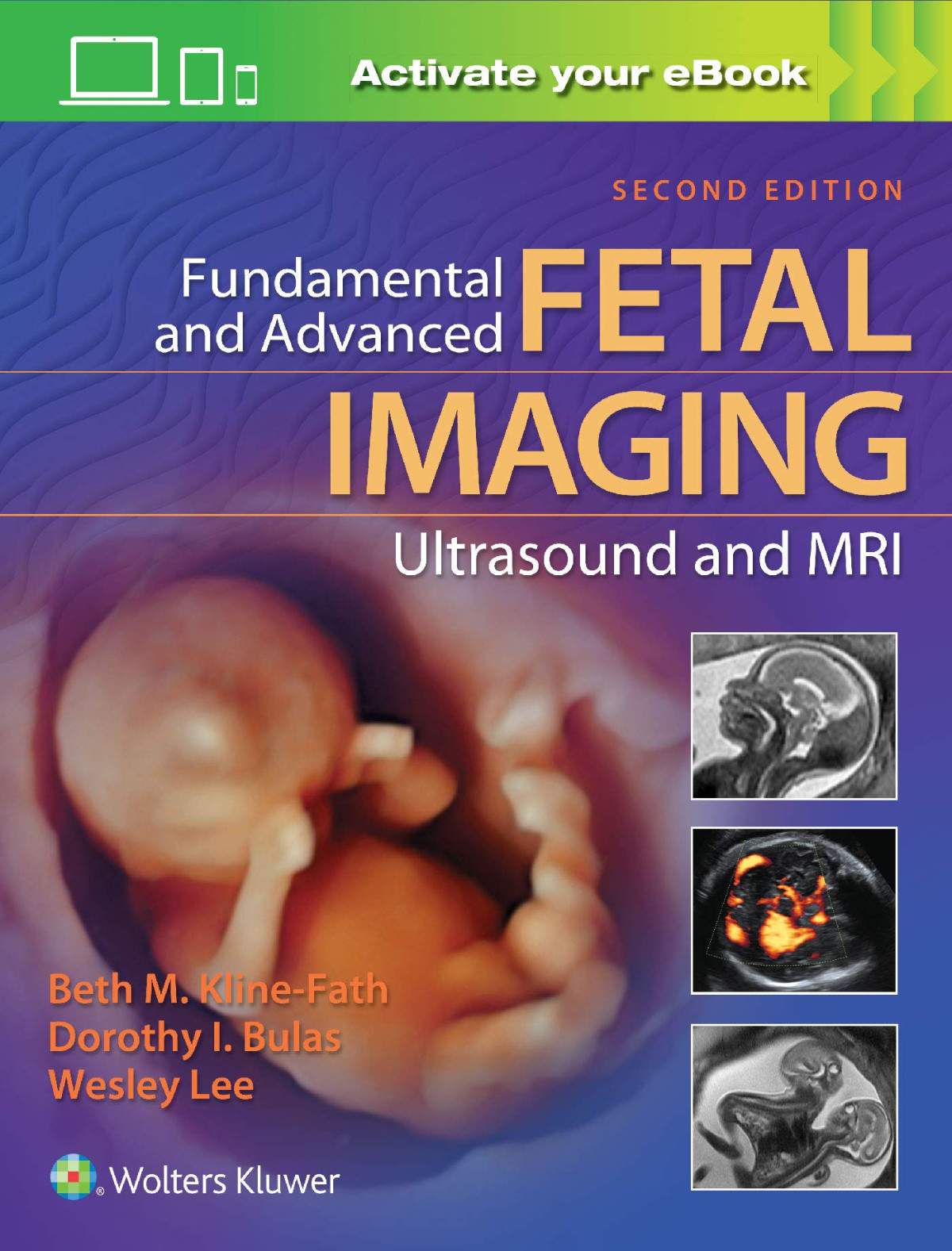 Fundamental And Advanced Fetal Imaging Ultrasound And Mri 2nd Edition Beth Klinefath