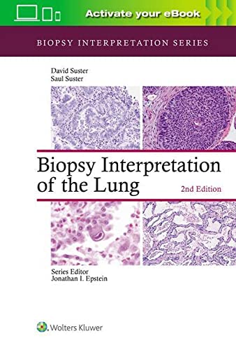 Biopsy Interpretation Of The Lung 2nd Edition Saul Suster David Suster