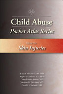 Child Abuse Pocket Atlas Seriesvolume 1skin Injuries Randell Alexander