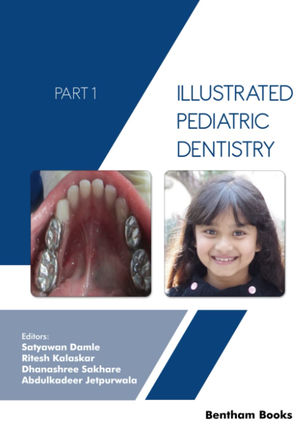Illustrated Pediatric Dentistry Part 1 Satyawan Damle Ritesh Kalaskar