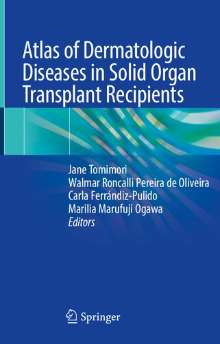 Atlas Of Dermatologic Diseases In Solid Organ Transplant Recipients Jane Tomimori