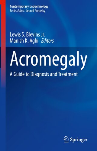 Acromegaly A Guide To Diagnosis And Treatment Lewis S Blevins Jr