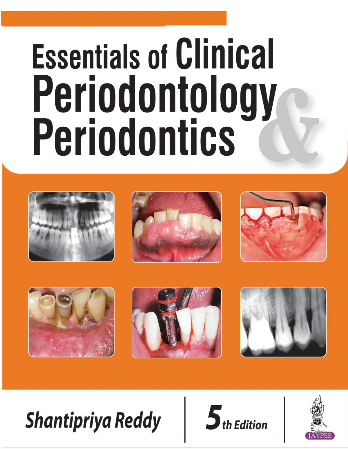 Essentials Of Clinical Periodontology Periodontics 5th Edition Shantipriya Reddy