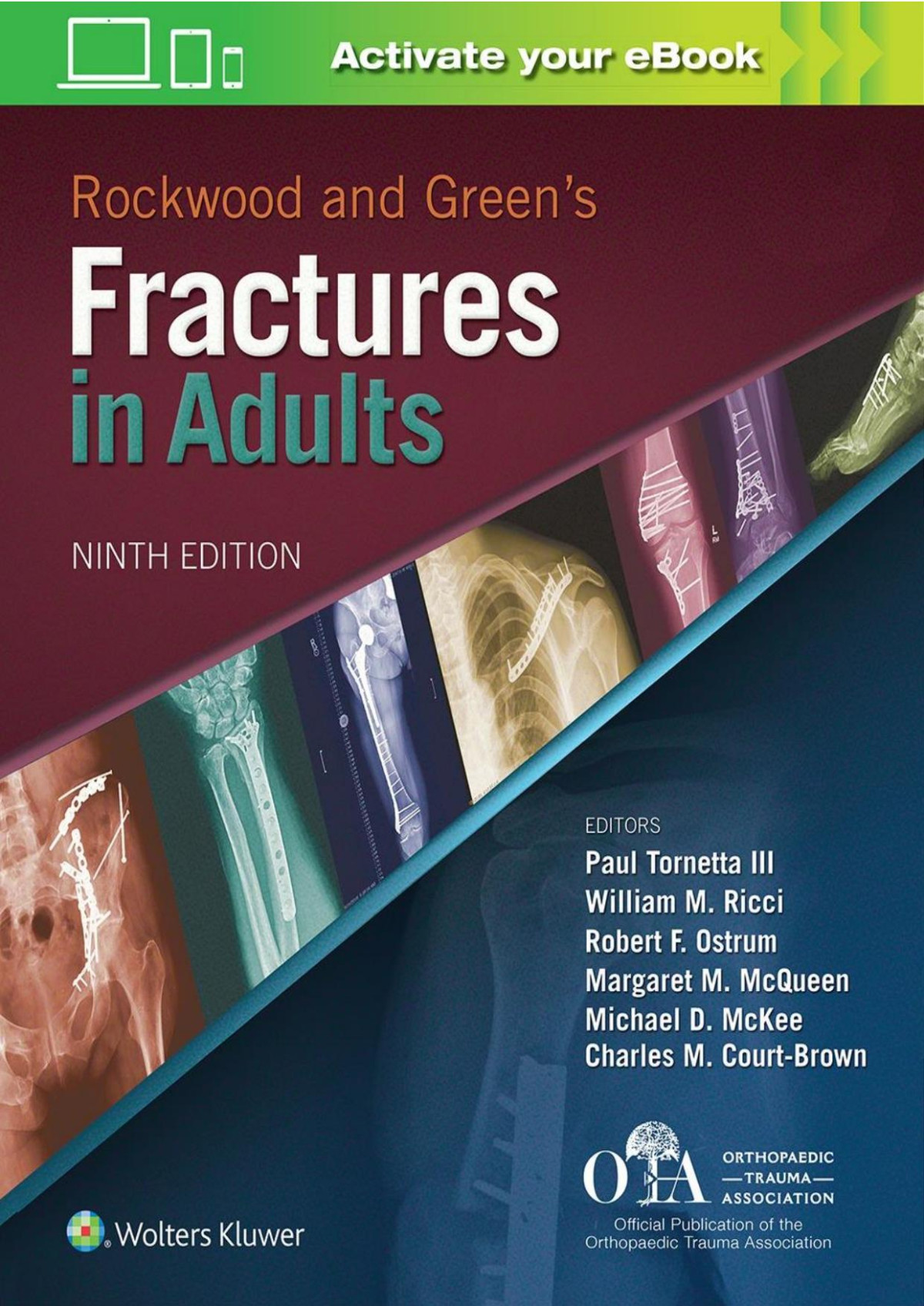 Rockwood And Greens Fractures In Adults 9th Edition Paul Tornetta Iii