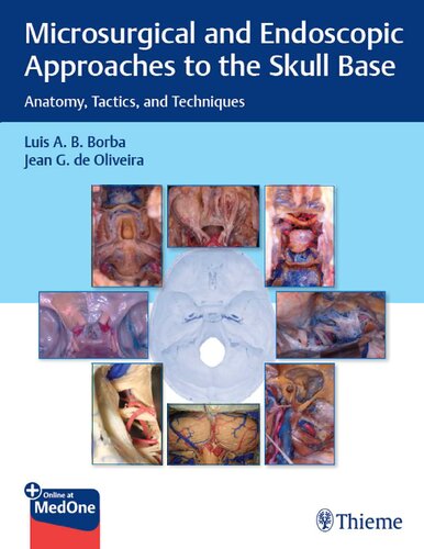 Microsurgical And Endoscopic Approaches To The Skull Base 1st Edition Luis A B Borba