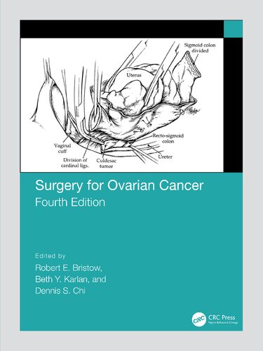 Surgery For Ovarian Cancer 4th Edition Dr Robert E Bristow Md