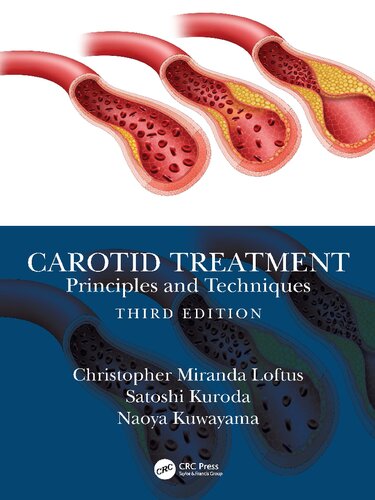 Carotid Treatment Principles And Techniques 3rd Edition Christopher M Loftus