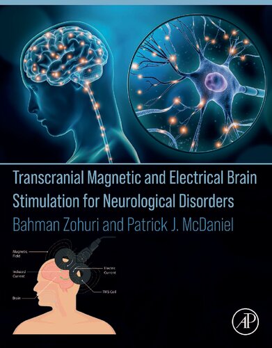 Transcranial Magnetic And Electrical Brain Stimulation For Neurological Disorders 1st Edition Bahman Zohuri