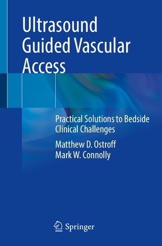Ultrasound Guided Vascular Access Practical Solutions To Bedside Clinical Challenges Matthew D Ostroff