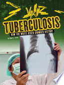 Tuberculosis How The White Death Changed History Mark K Lewis