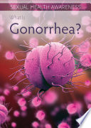 What Is Gonorrhea Sadie Silva
