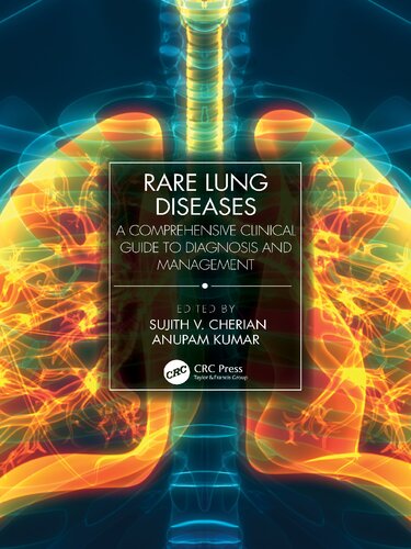 Rare Lung Diseases A Comprehensive Clinical Guide To Diagnosis And Management 1st Sujith V Cherian