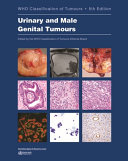 Urinary And Male Genital Tumours 5th Edition Who Classification Of Tumours Editorial Board