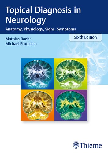 Duus Topical Diagnosis In Neurology 6th Edition Mathias Bhr