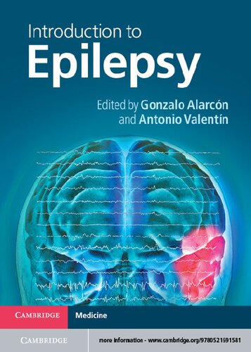 Introduction To Epilepsy 1st Gonzalo Alarcón Antonio Valentín