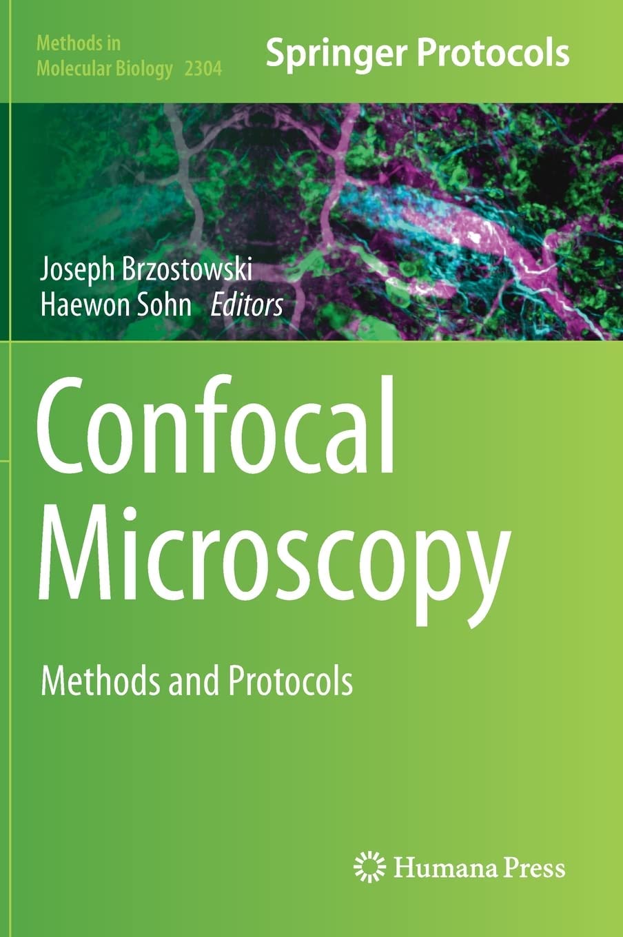 Confocal Microscopy 1st Joseph Brzostowski Haewon Sohn