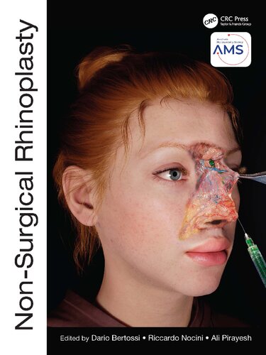 Nonsurgical Rhinoplasty Dario Bertossi Riccardo Nocini Ali Pirayesh