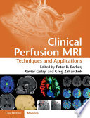 Clinical Perfusion Mri Techniques And Applications Peter B Barker