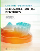 Kratochvils Fundamentals Of Removable Partial Dentures 1st Edition Tingling Chang
