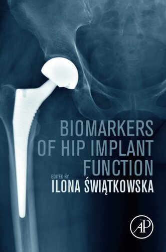 Biomarkers Of Hip Implant Function Diagnostic Modalities To Prevent Chronic Periprosthetic Joint Infection And Implant Failure Ilona Swiatkowska
