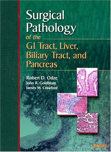 Surgical Pathology Of The Gi Tract Liver Biliary Tract And Pancreas 1st Edition Robert Odze