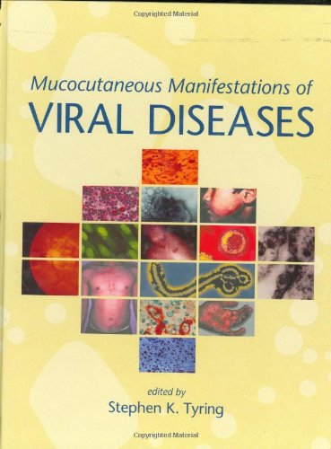 Mucocutaneous Manifestations Of Viral Diseases 1st Edition Stephen Tyring