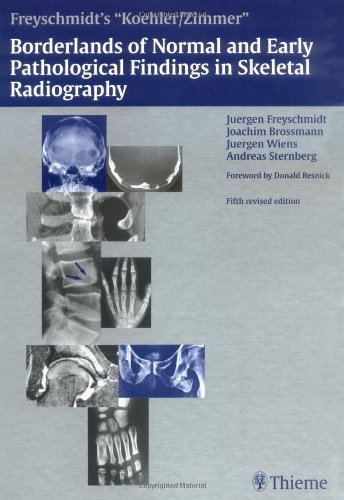 Koehler Zimmers Borderlands Of Normal And Early Pathological Findings In Skeletal Radiography 5th Jurgen Freyschmidt