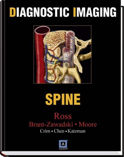 Diagnostic Imaging Spine 1st Edition Jeff Ross Michael Brantzawadzki