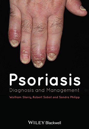 Psoriasis Diagnosis And Management 1st Edition Wolfram Sterry