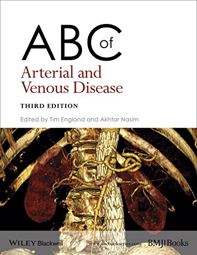 Abc Of Arterial And Venous Disease 3rd Edition Tim England Akhtar Nasim