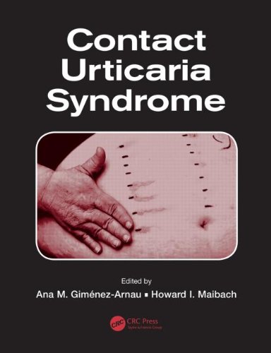 Contact Urticaria Syndrome 1st Edition Ana M Gimenezarnau Howard I Maibach