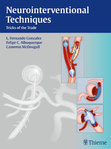 Neurointerventional Techniques Tricks Of The Trade 1st Edition Fernando L Gonzalez