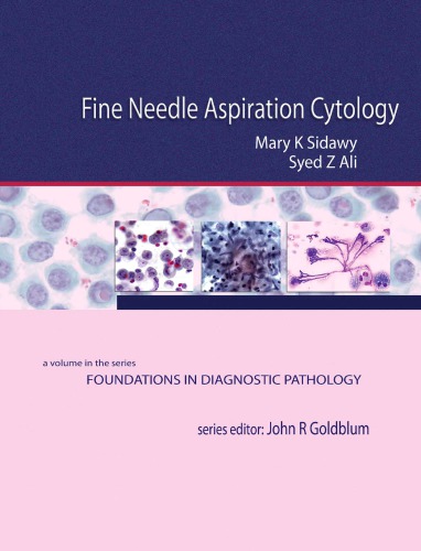 Fine Needle Aspiration Cytology A Volume In Foundations In Diagnostic Pathology 1st Mary K Sidawy Ed
