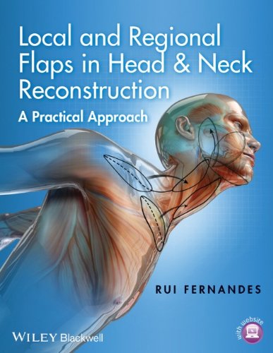 Local And Regional Flaps In Head Neck Reconstruction A Practical Approach 1st Edition Rui Fernandes