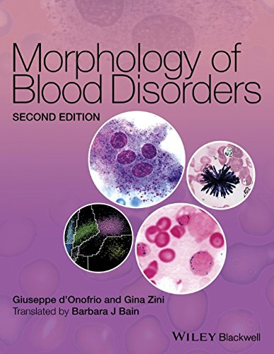 Morphology Of Blood Disorders 2nd Edition Giuseppe Donofrio