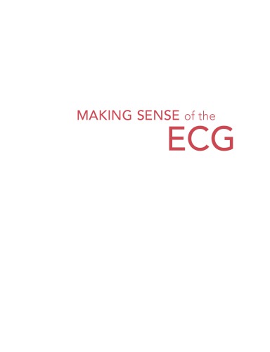Making Sense Of The Ecg A Handson Guide Fourth Edition Daniel J Alesch