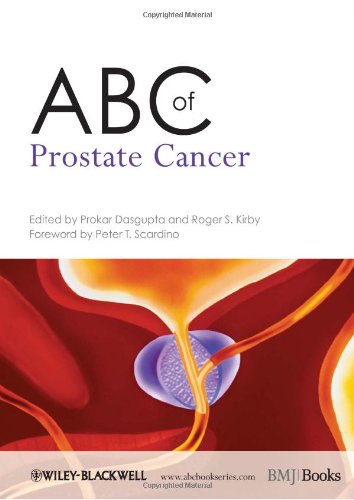 Abc Of Prostate Cancer 1st Edition Prokar Dasgupta R S Kirby